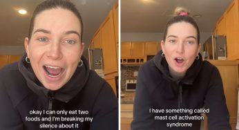 "Sono allergica a tutto: ci sono solo due cose che posso mangiare"